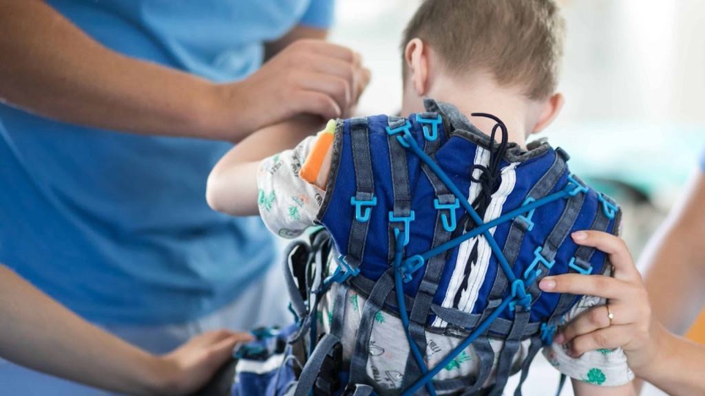 Ребенок с церебральным параличем